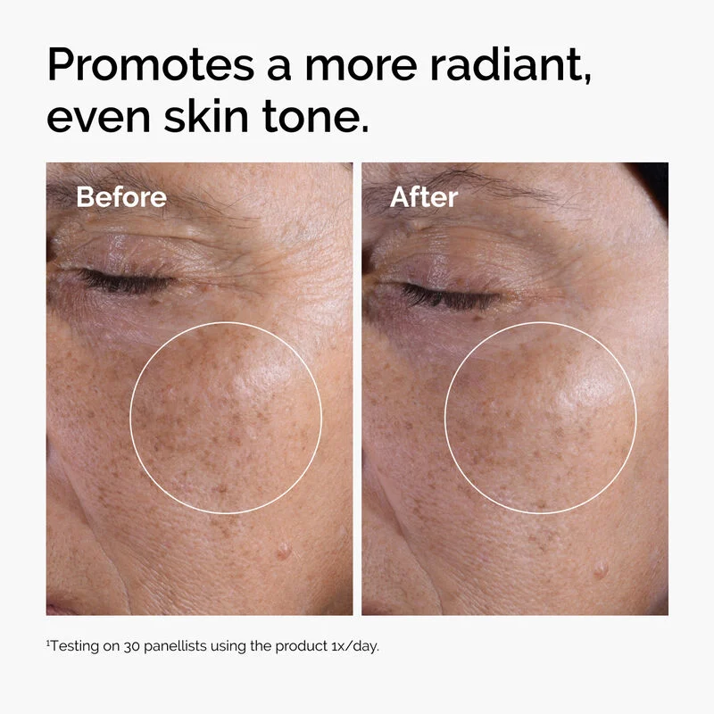 The Ordinary Glycolic Acid 7% Toning Solution 240ml For Gentle Exfoliation & Skin Brightening