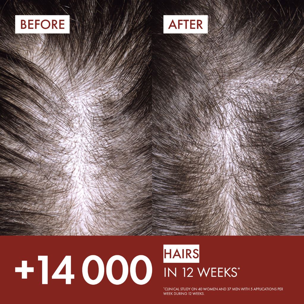 Vichy Dercos Aminexil Clinical R.e.g.e.n Anti-hair Loss Treatment – Helps Reduce Hair Loss & Support Hair Density