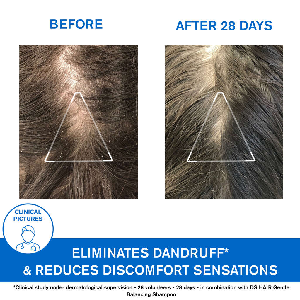Uriage Ds Hair Anti-dandruff Shampoo For Flake Control 200ml