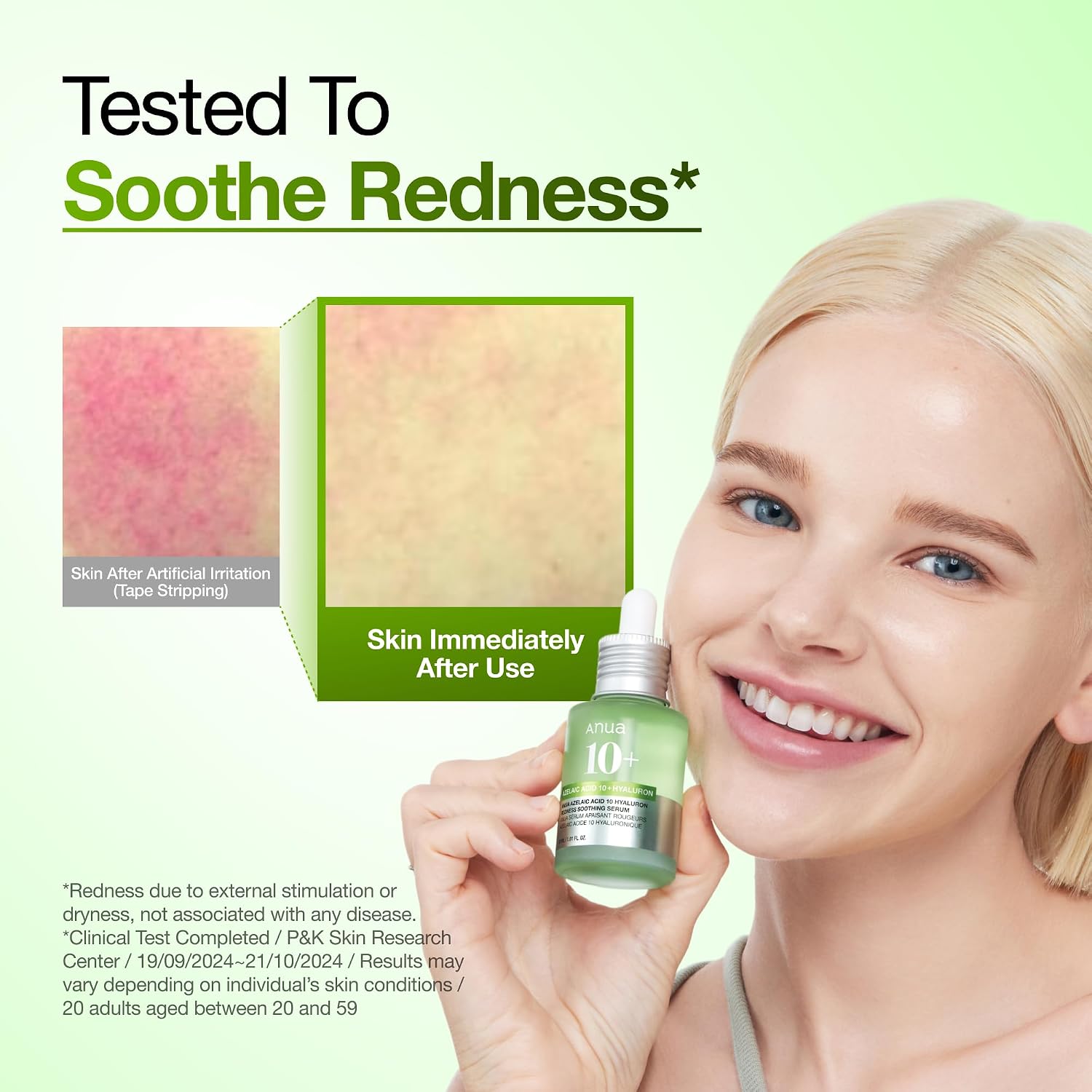 Anua Azelaic Hyaluron Soothing Serum 30ml For Redness Relief, Hydration & Skin Brightening