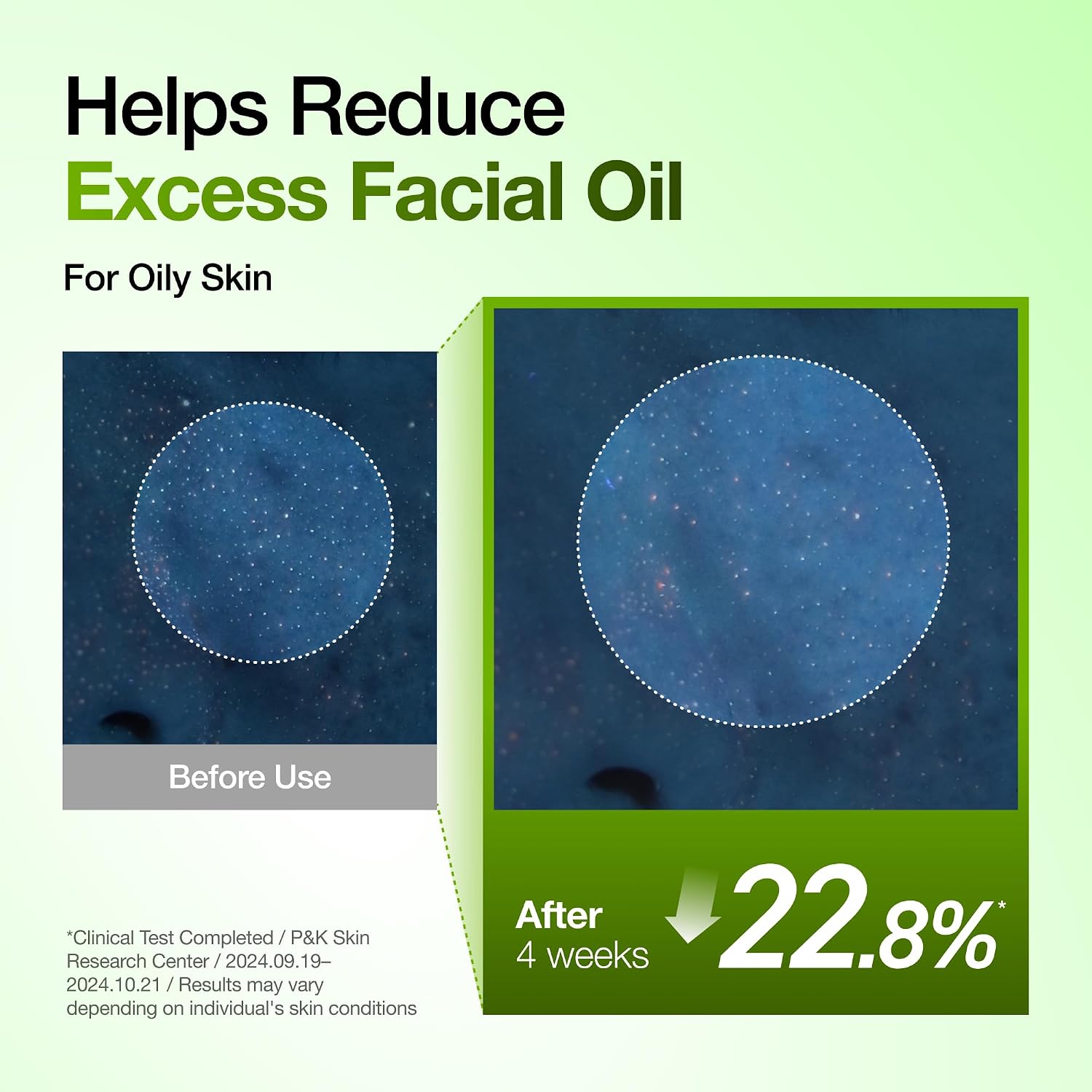 Anua Azelaic Hyaluron Soothing Serum 30ml For Redness Relief, Hydration & Skin Brightening