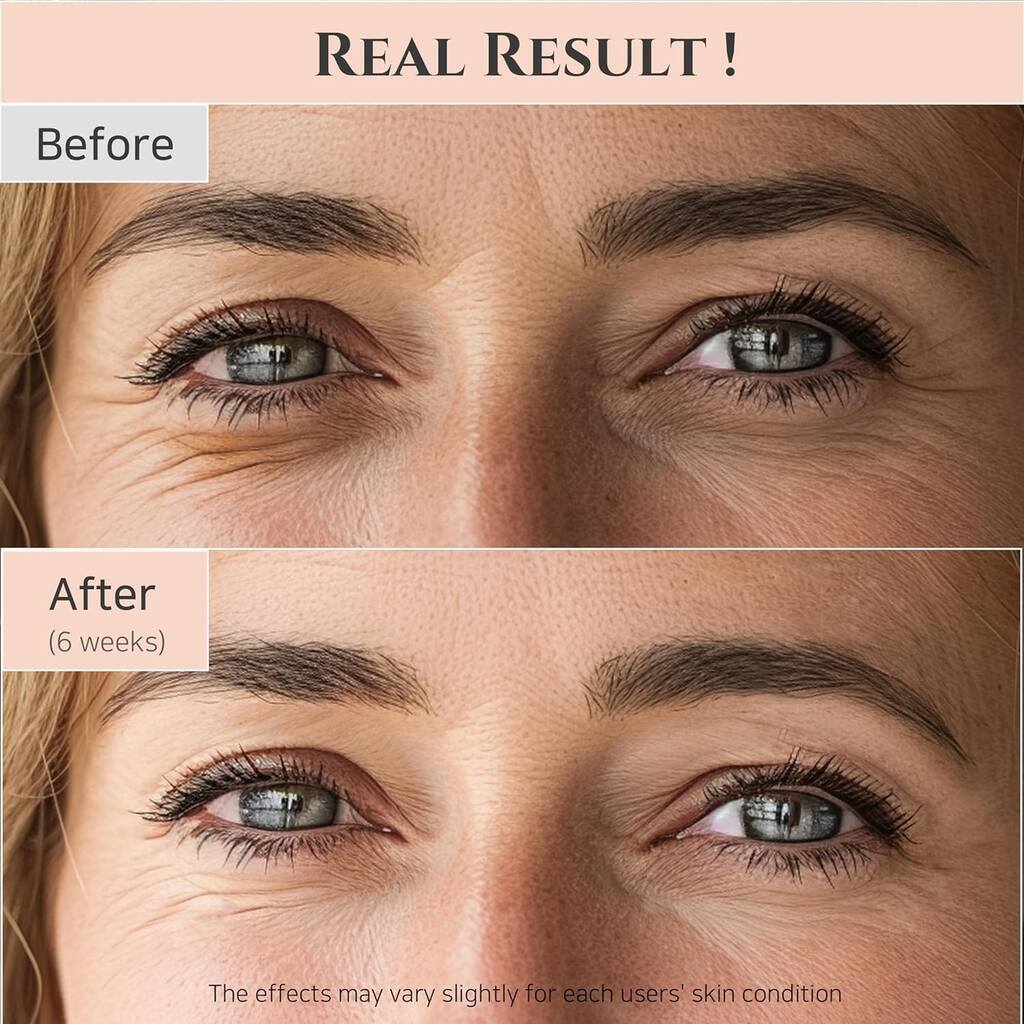 Beauty Of Joseon Revive Eye Serum Ginseng + Retinal 30ml For Wrinkle Care, Firming & Eye Rejuvenation