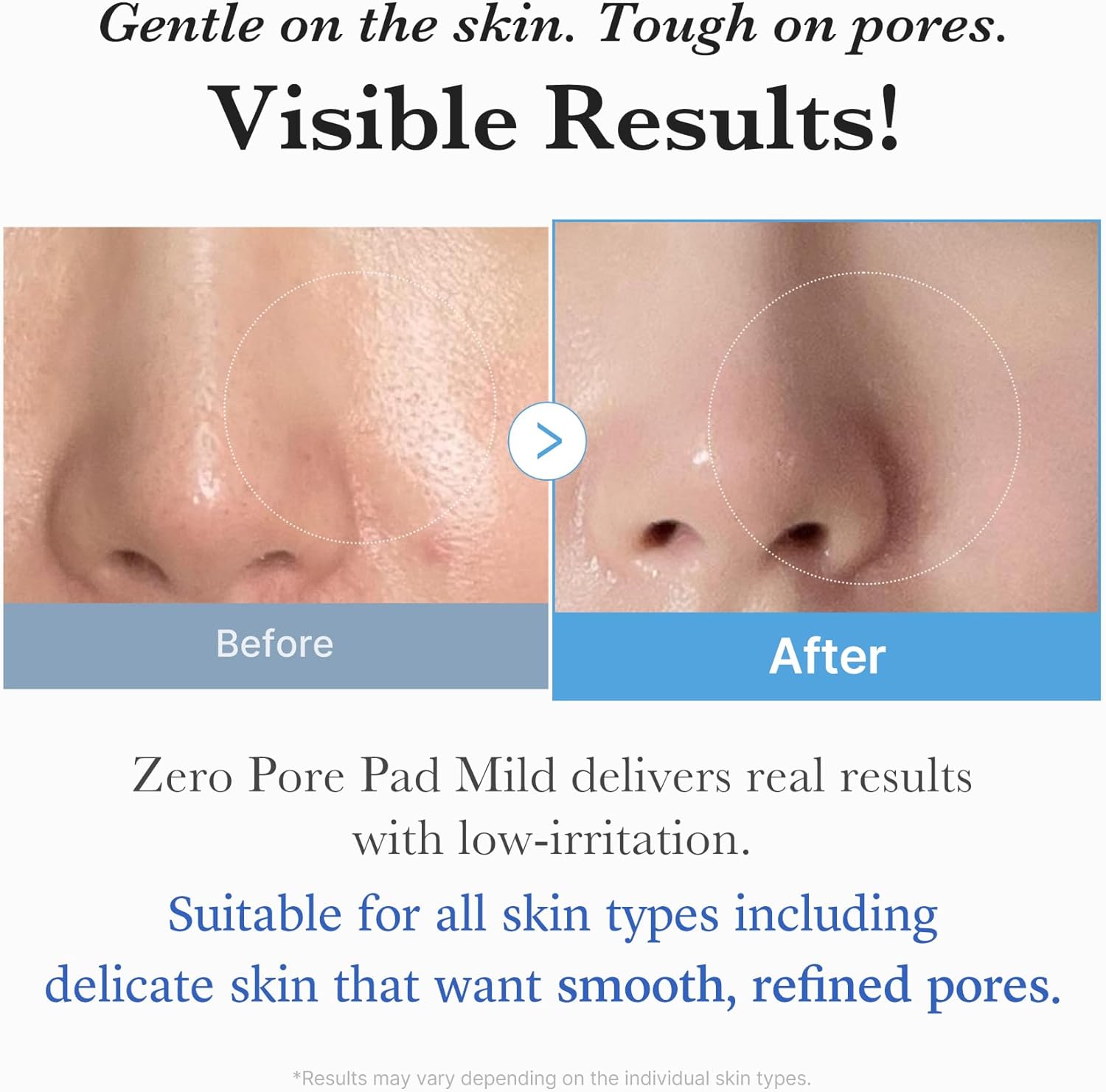 Medicube Zero Pore Pad 2.0 155g For Pore Refining, Gentle Exfoliation & Smoother Skin