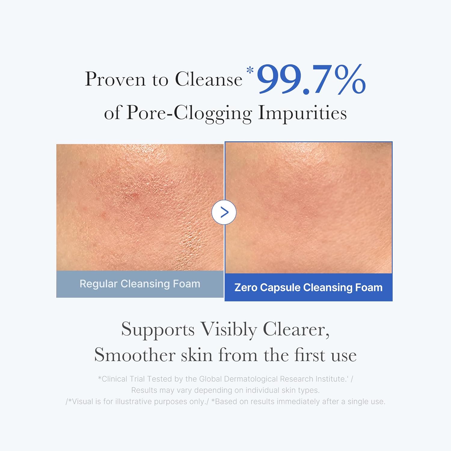 Medicube Zero Pore Sa Clear Capsule Cleansing Foam 120g For Deep Cleansing, Pore Care & Oil Control