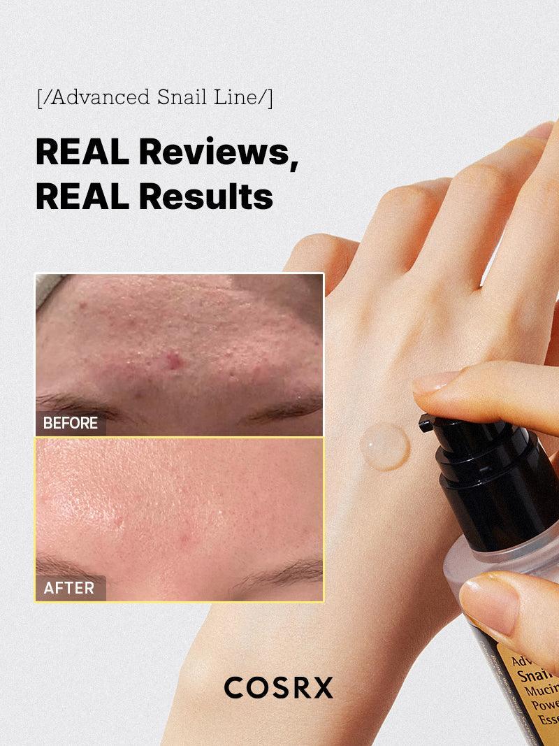 Cosrx Advanced Snail 96 Mucin Power Essence 100ml For Hydration, Repair & Glowing Skin