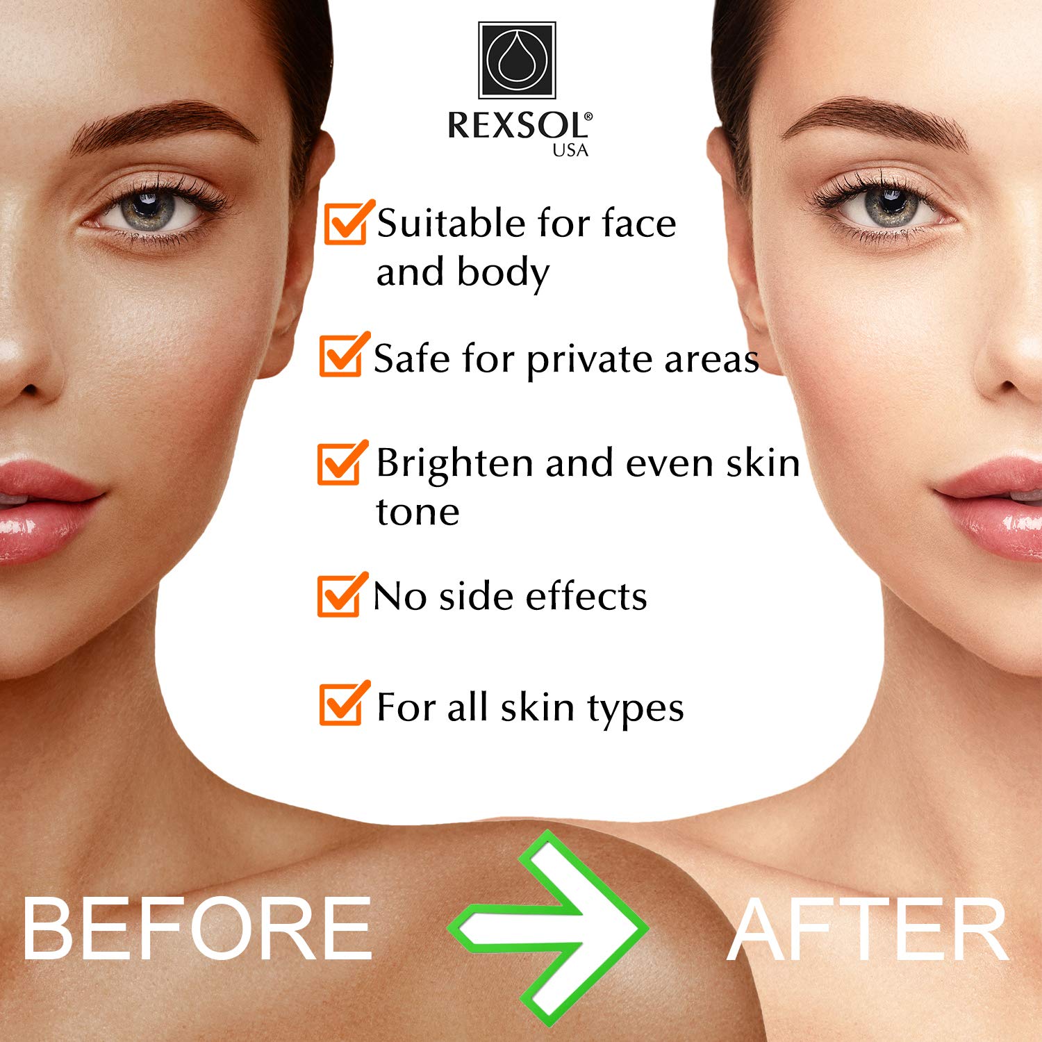 Rexsol Ultra Whitening Cream
