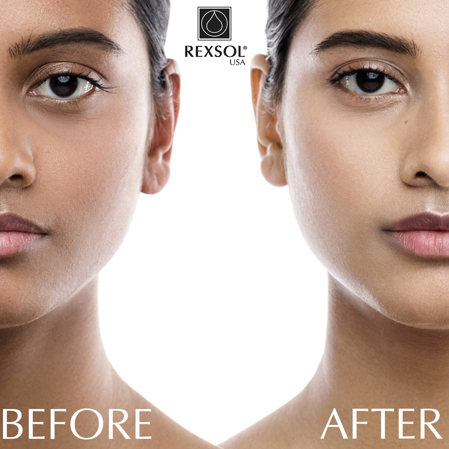 Rexsol Ultra Whitening Cream