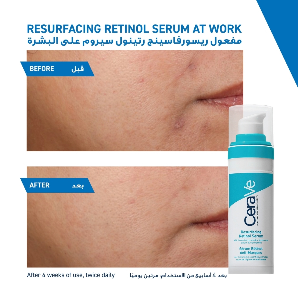 Cerave Resurfacing Retinol Serum For Post-acne Marks & Skin Texture 30ml