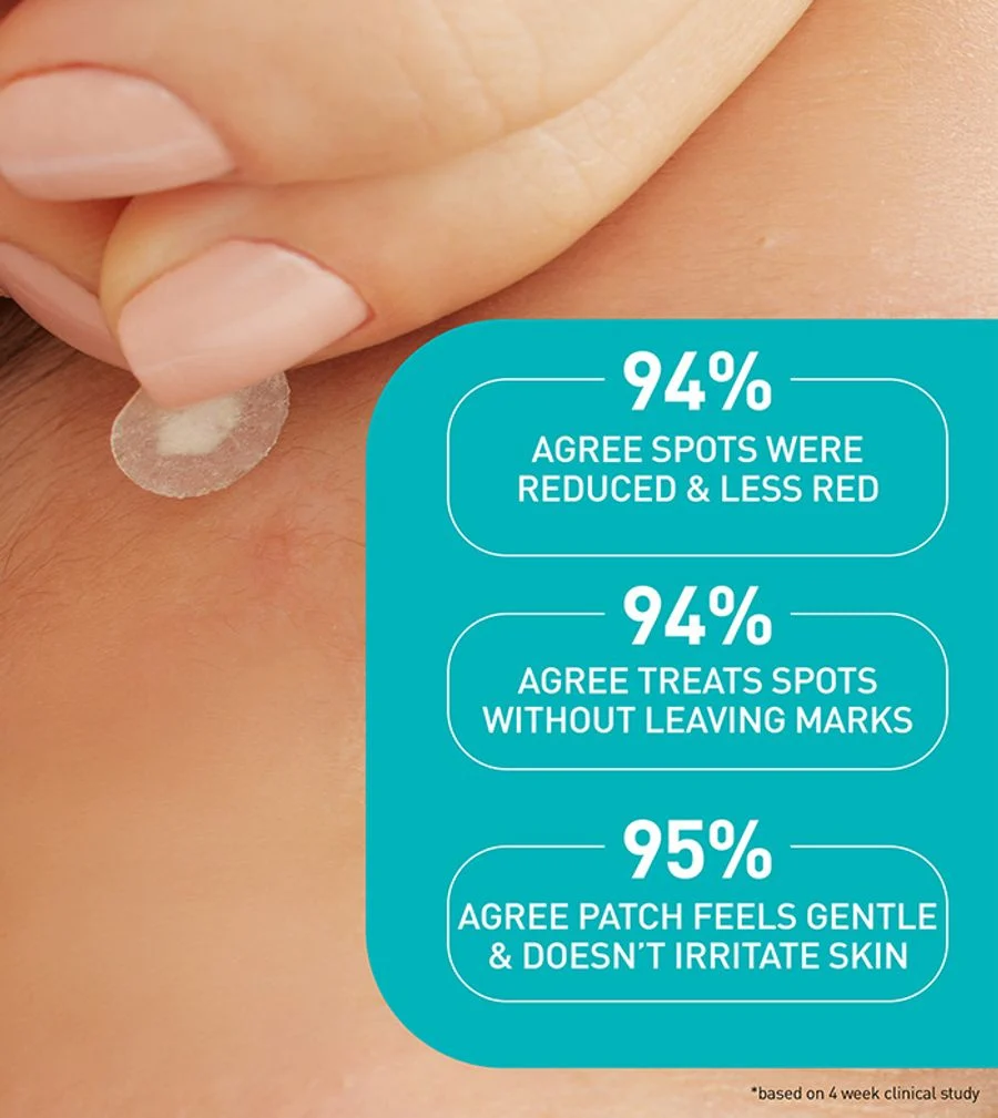 Cerave Blemish Barrier Patches 22's For Acne Pimples, Spot Protection & Faster Healing