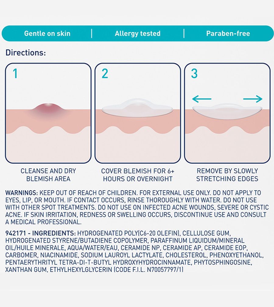 Cerave Blemish Barrier Patches 22's For Acne Pimples, Spot Protection & Faster Healing