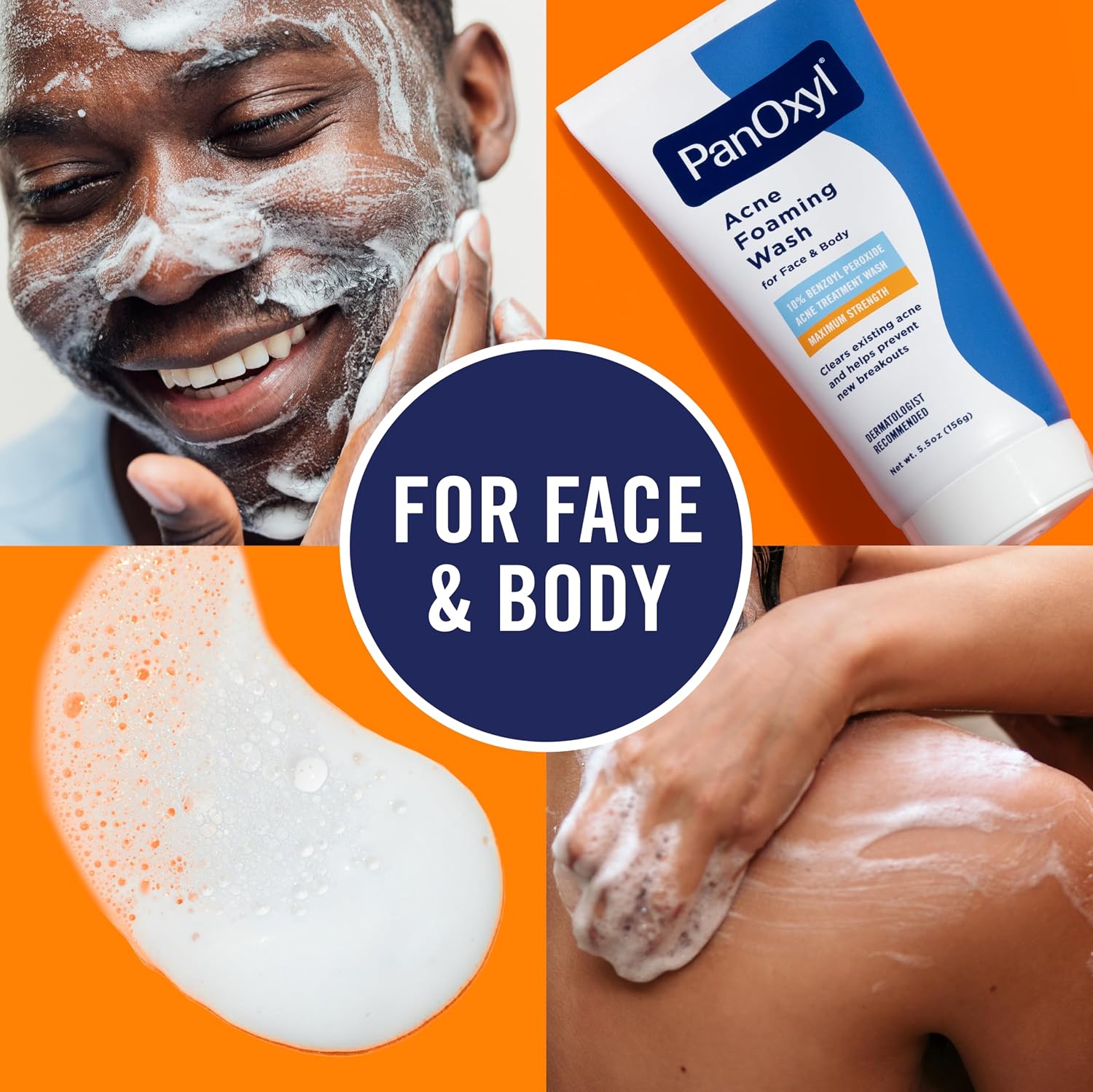 Panoxyl Acne Foaming Wash 10% Benzoyl Peroxide 156g – Clears Acne & Helps Prevent Breakouts