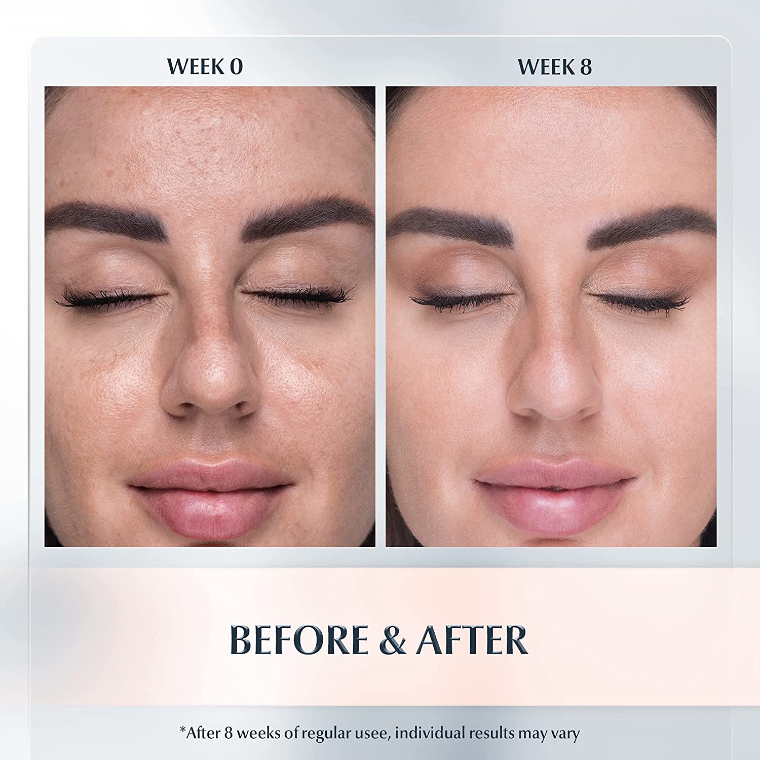 Eucerin Even Pigment Perfector Dual Serum -30ml