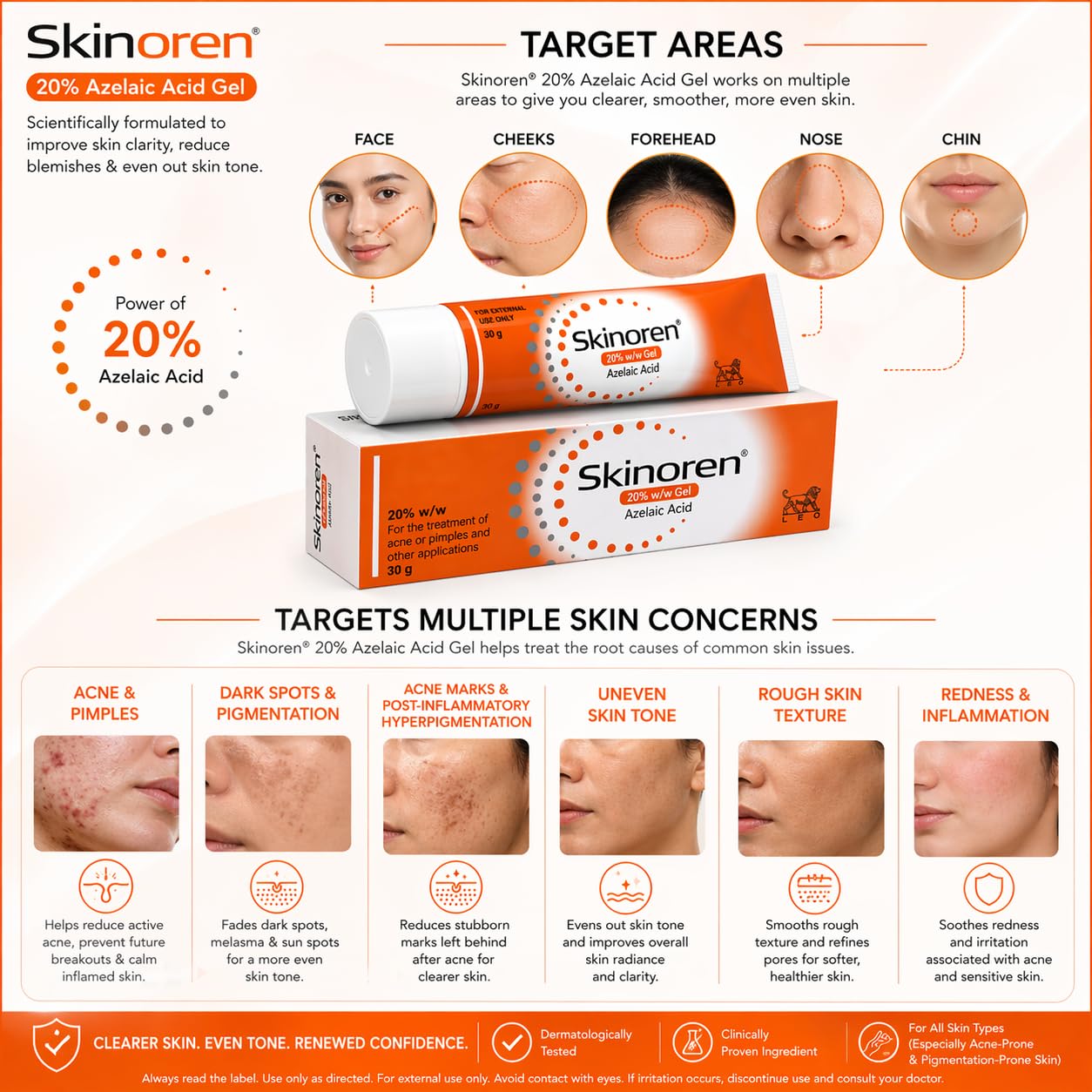 Skinoren Azelaic Acid 20% Cream 30g – Prescription Acne Treatment For Acne Vulgaris